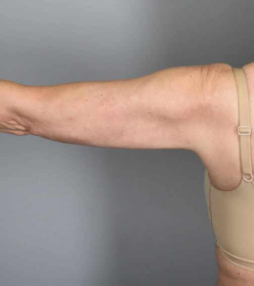 Case # 12 after photo