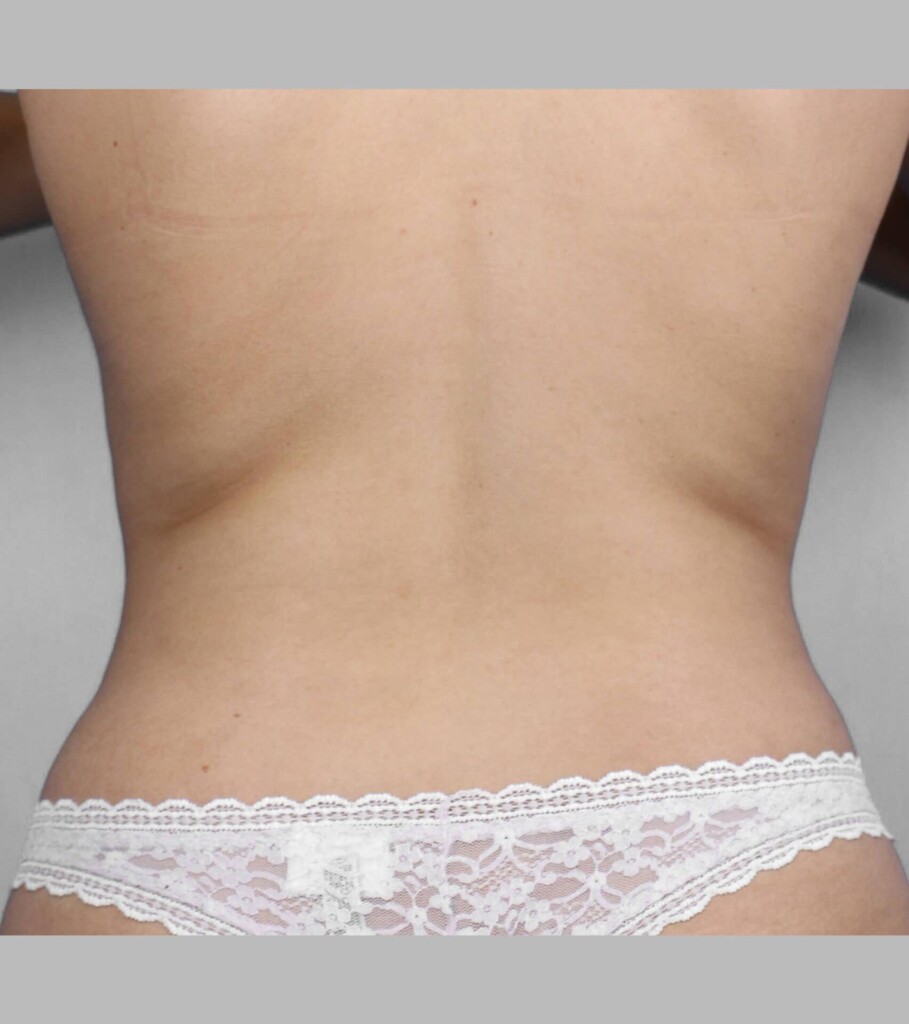 before and after gallery image