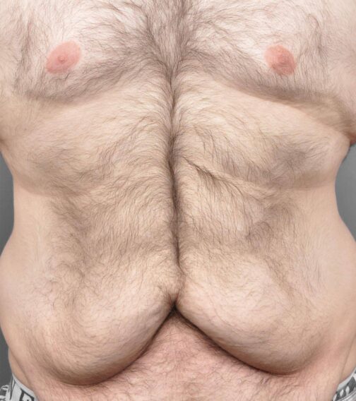 Case # 6 before photo