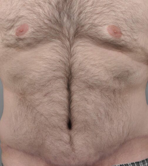 Case # 6 after photo