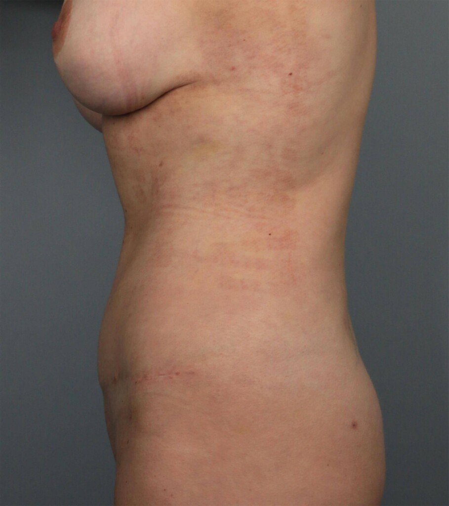 bna image
