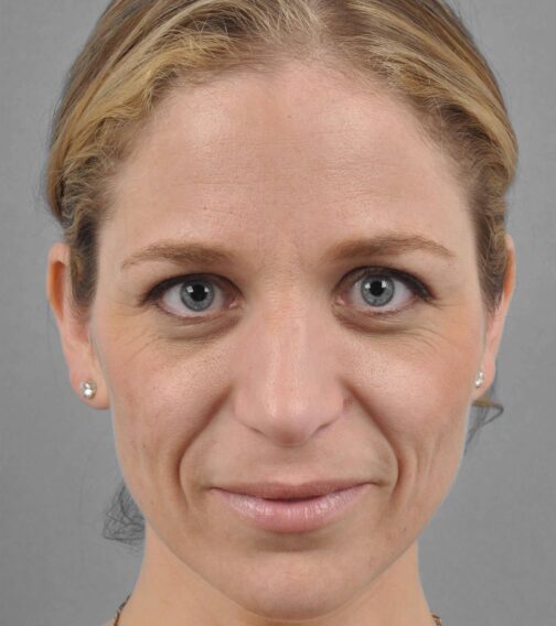 Case # 1 before photo