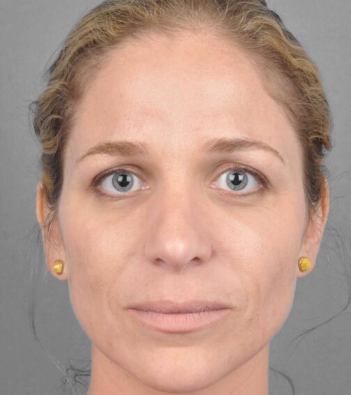 Case # 1 after photo