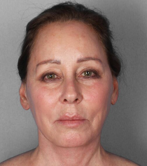 Case # 2 before photo