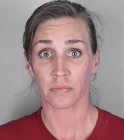 Case # 3 before photo