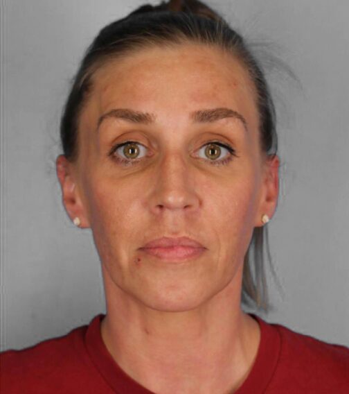 Case # 3 after photo