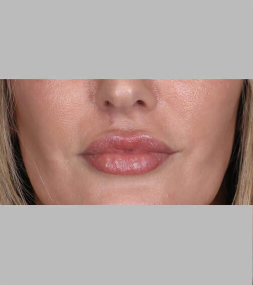 Case # 8 after photo