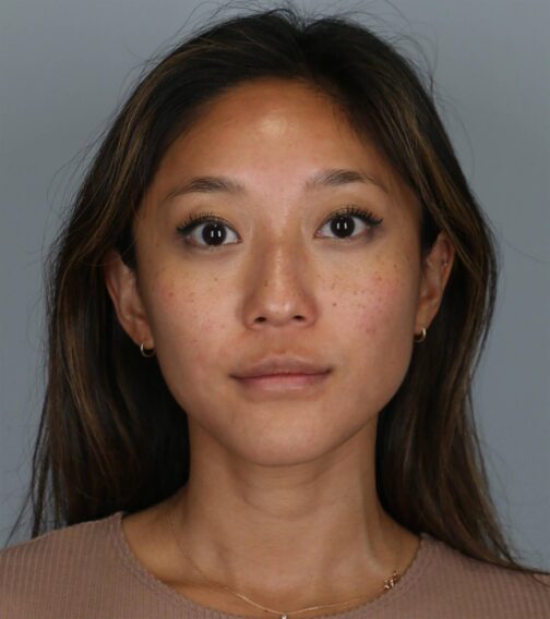 Case # 4 before photo