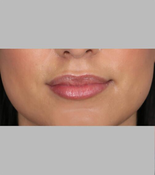 Case # 9 before photo