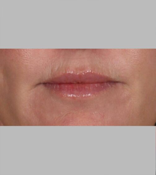 Case # 10 before photo