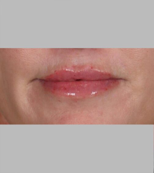 Case # 10 after photo