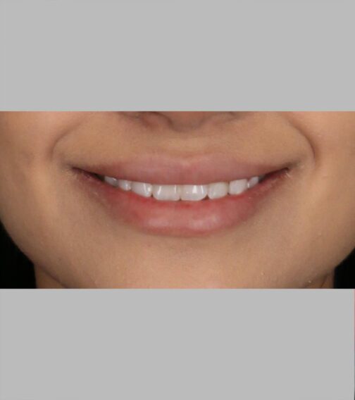 Case # 11 before photo