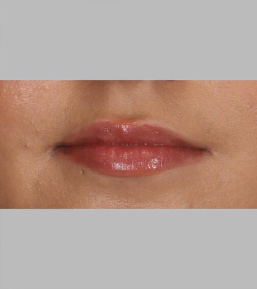 Case # 12 before photo