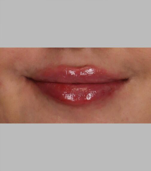 Case # 12 after photo