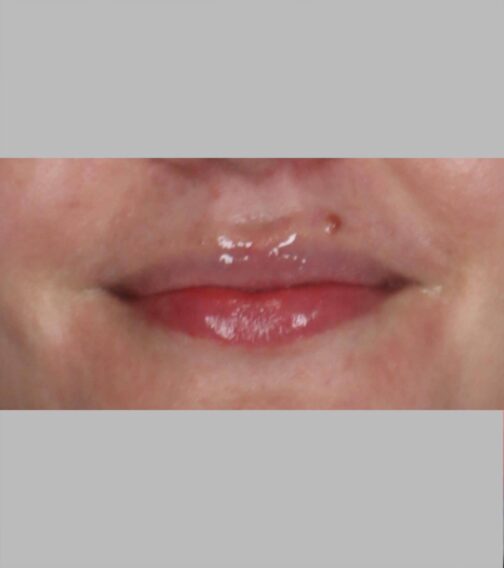 Case # 13 before photo