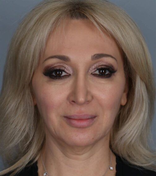 Case # 5 before photo