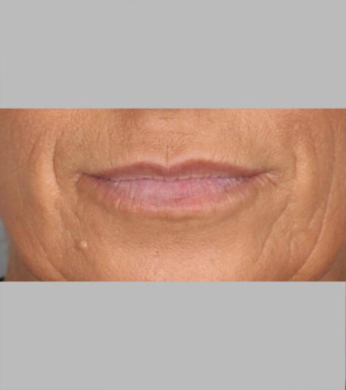 Case # 15 before photo