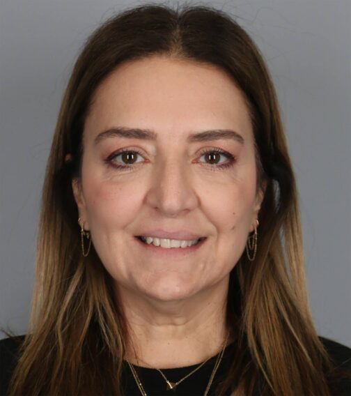 Case # 6 before photo