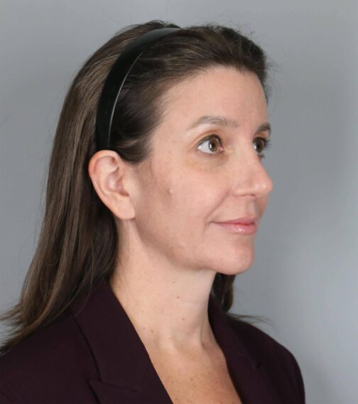 Case # 7 after photo