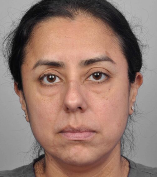 Case # 1 before photo