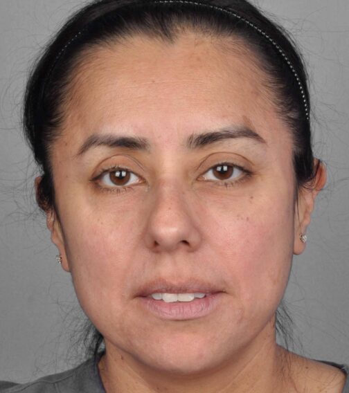 Case # 1 after photo