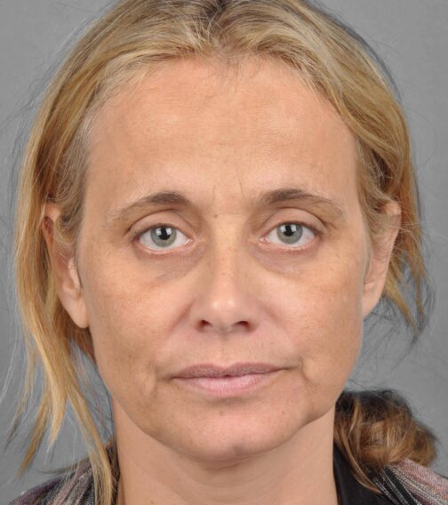 Case # 3 before photo