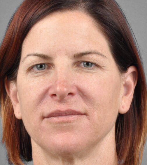 Case # 2 before photo