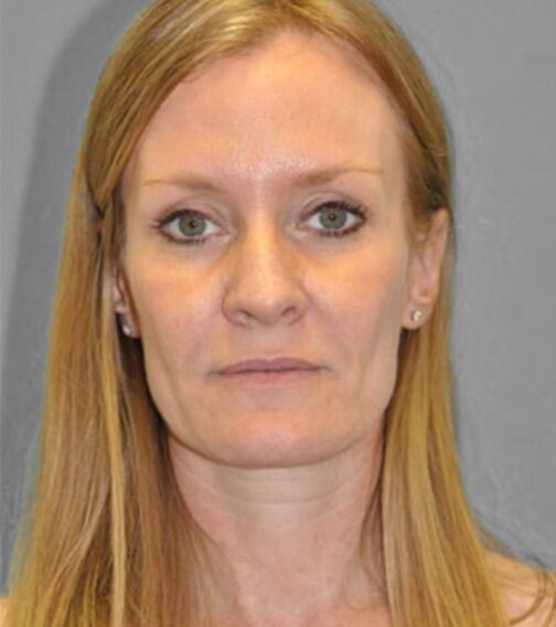 Case # 3 before photo