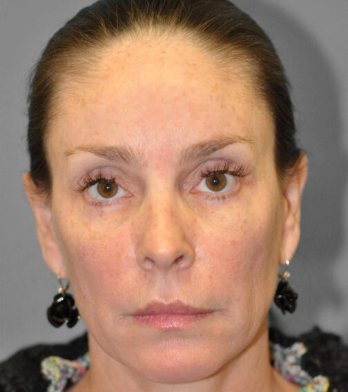 Case # 4 before photo