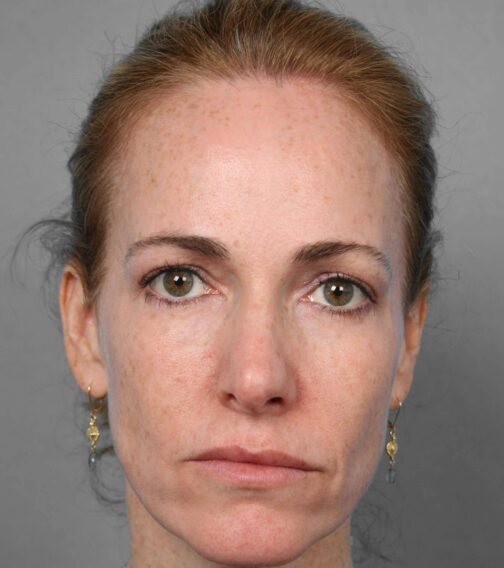 Case # 5 before photo