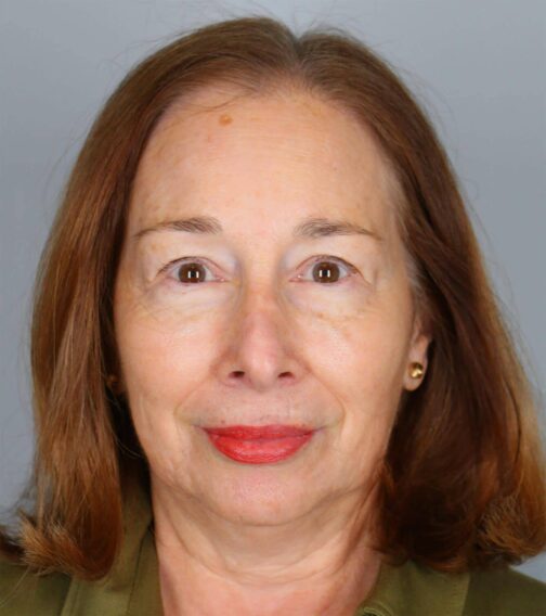 Case # 1 after photo