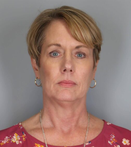 Case # 2 before photo