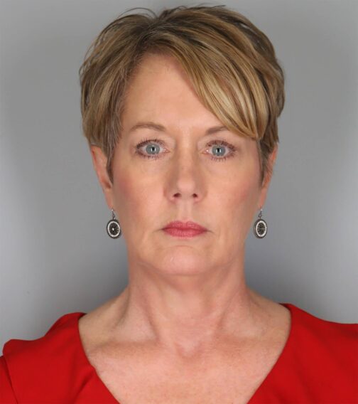 Case # 2 after photo