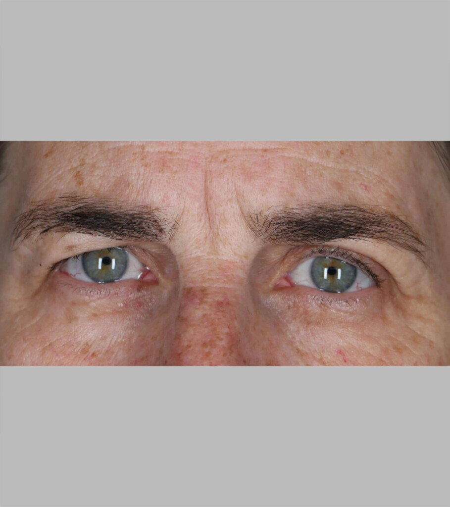 before and after gallery image