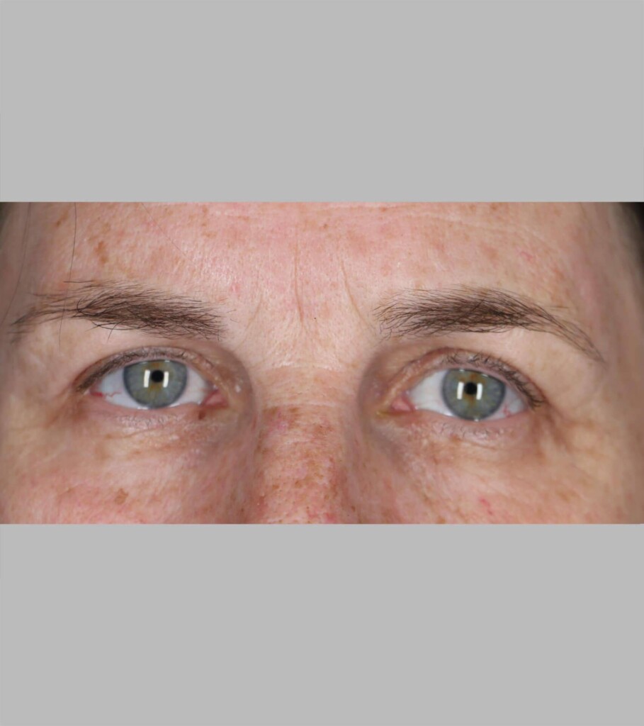 before and after gallery image