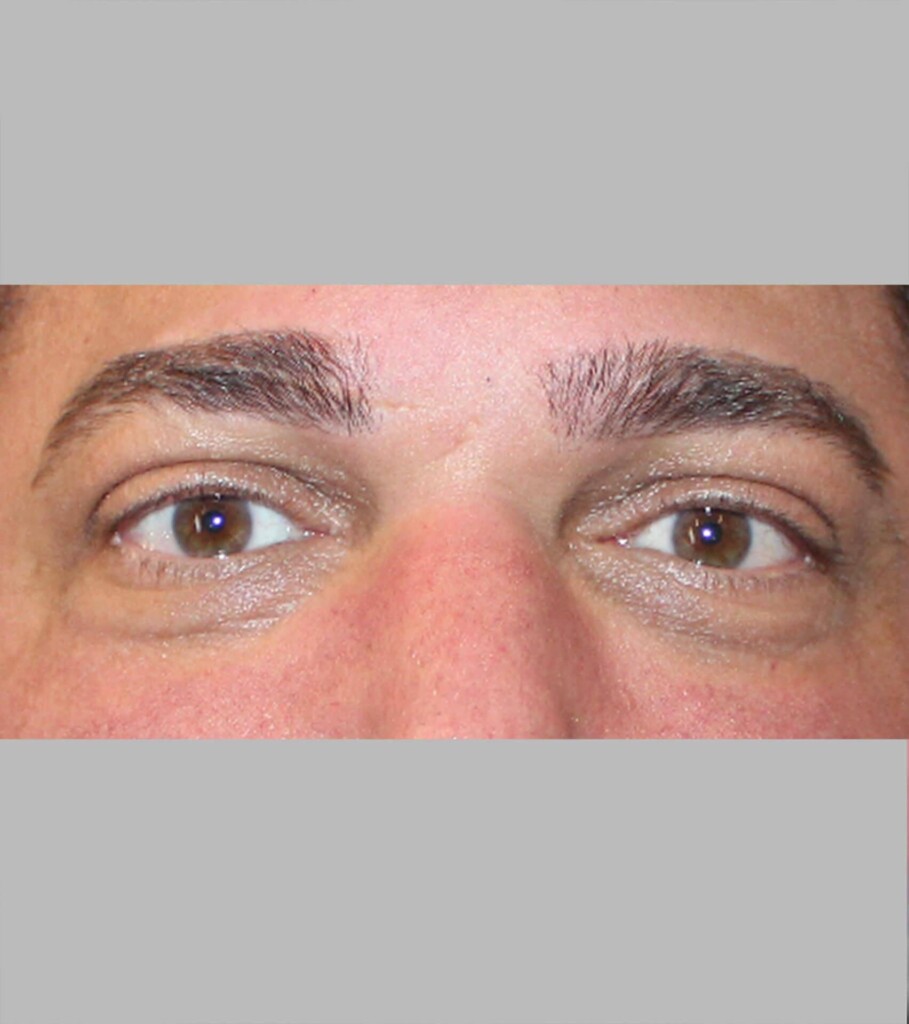 before and after gallery image