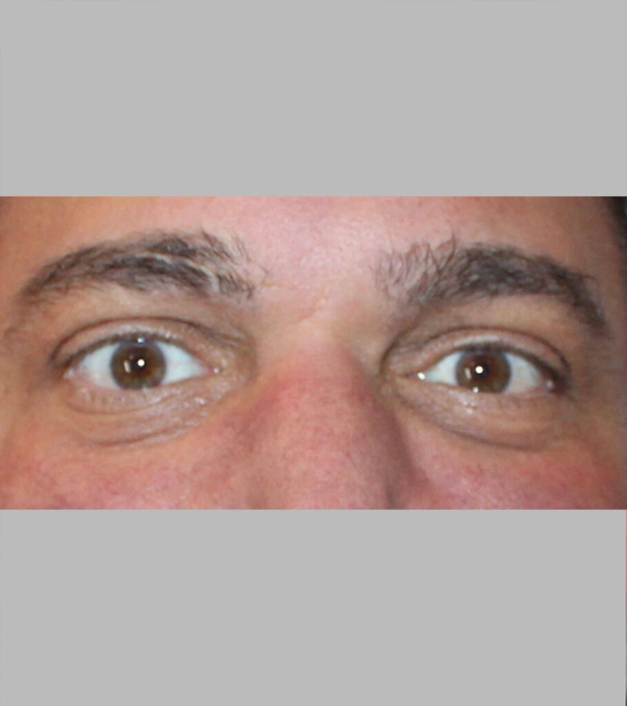 before and after gallery image