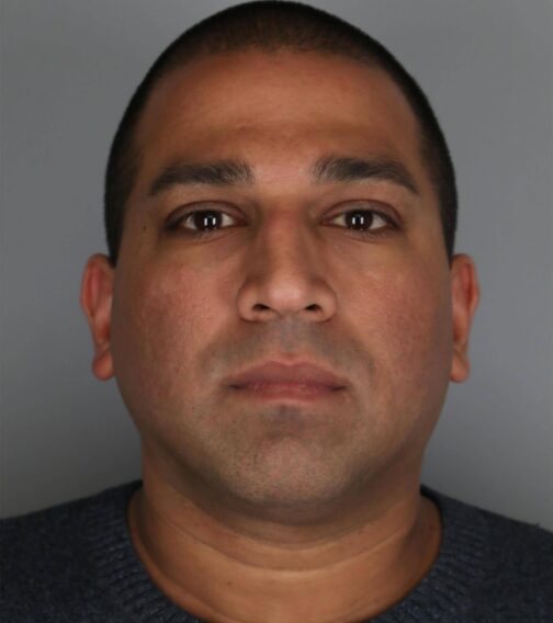 Case # 2 before photo