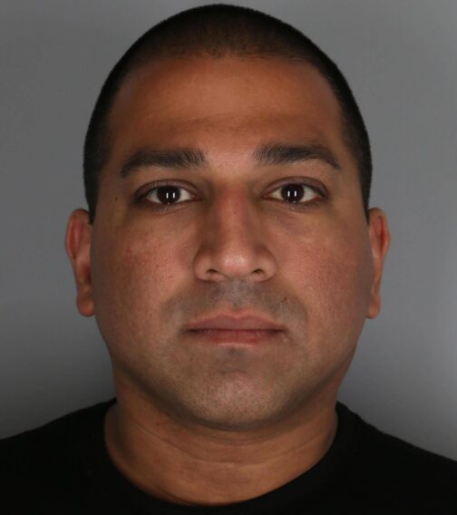 Case # 2 after photo