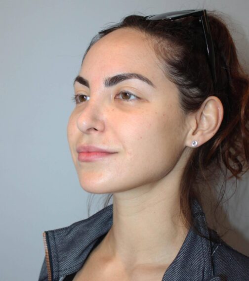 Case # 1 before photo