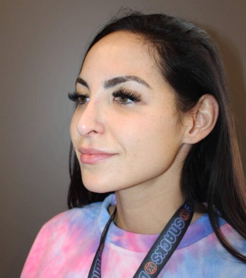 Case # 1 after photo