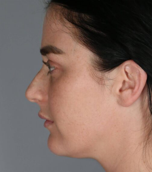 Case # 2 before photo