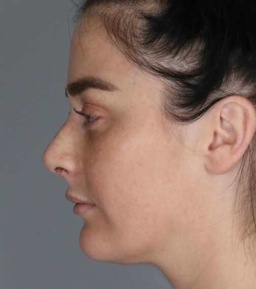 Case # 2 after photo