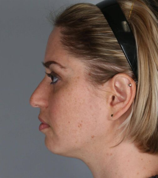 Case # 3 before photo