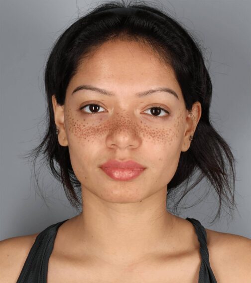 Case # 4 before photo