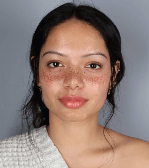 Case # 4 after photo