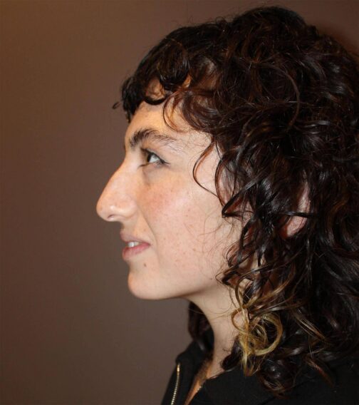 Case # 6 before photo