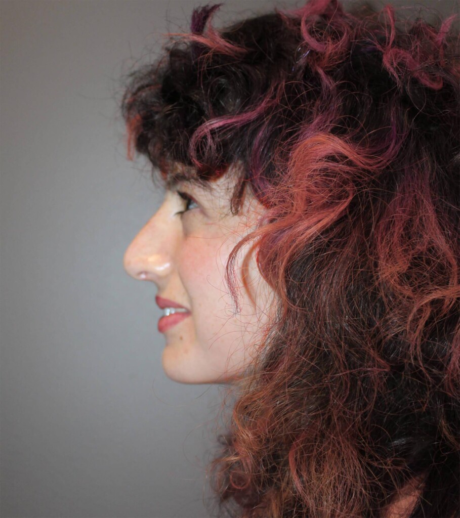 before and after gallery image